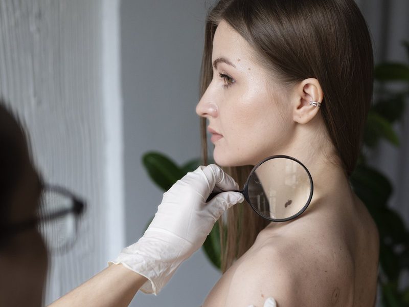 Dermatología