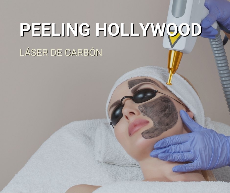 peeling hollywood