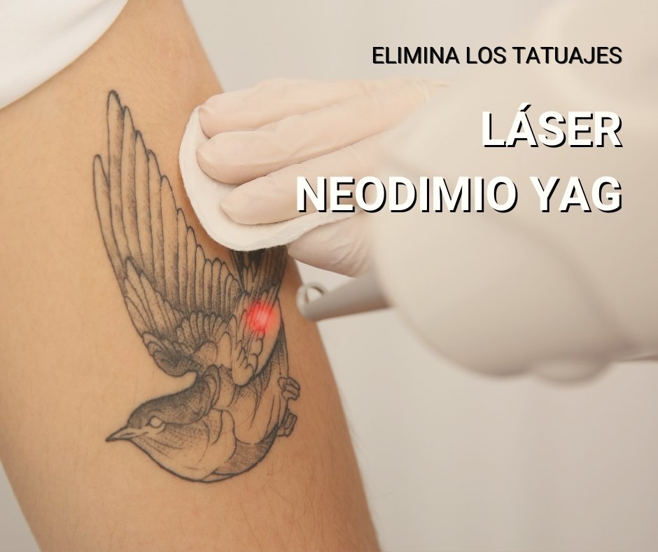 laser neodimio yag